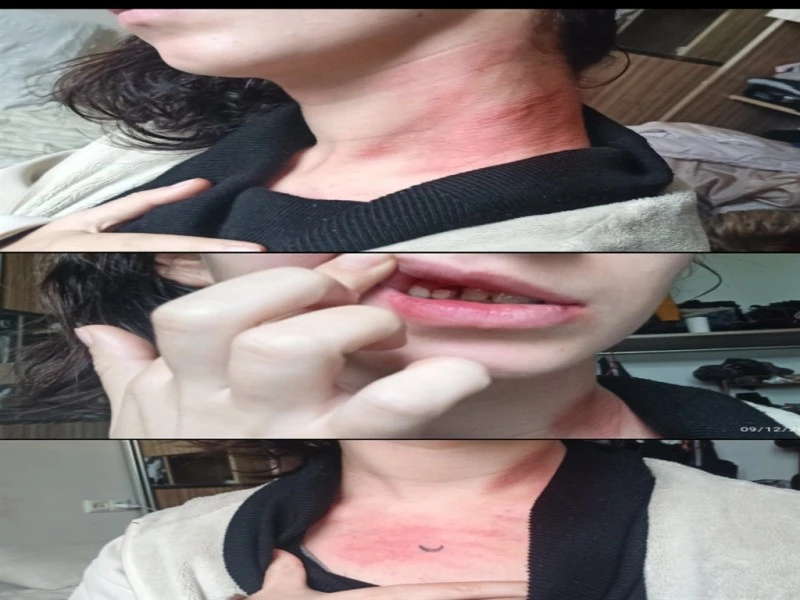 Parkta genç kıza kafa atıp, boğazını sıkan şüpheliye ödül gibi ceza