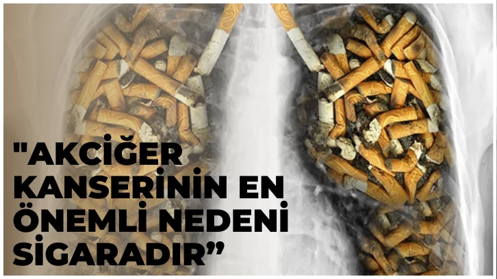 "Akciğer Kanserinin En Önemli Nedeni Sigaradır”