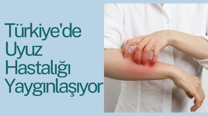 Türkiye'de Uyuz Hastalığı Yaygınlaşıyor 