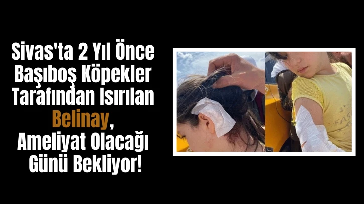 Sivas'ta 2 Yıl Önce Başıboş Köpekler Tarafından Isırılan Belinay Ameliyat Olacağı Günü Bekliyor!