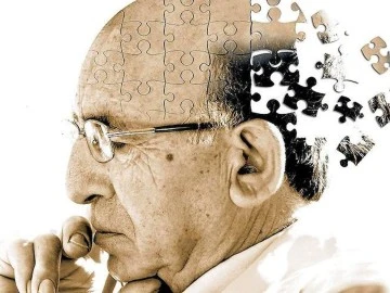 Alzheimer'dan Korunmak İçin Bunları Yapın 